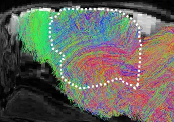 Scientists create mice with part-human brains