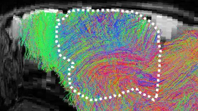 Scientists create mice with part-human brains